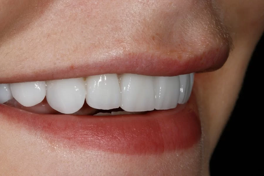 Joyful Smiles by Dr. Joy Brauer Picture 4