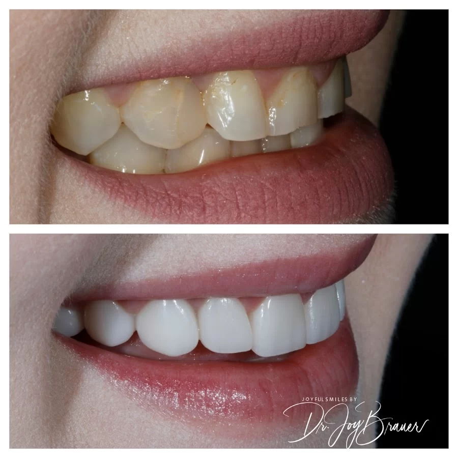 Joyful Smiles by Dr. Joy Brauer Picture 9