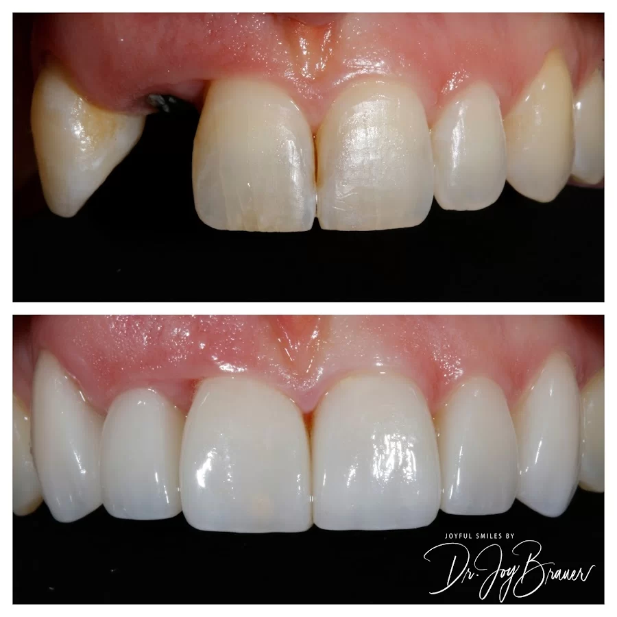 Joyful Smiles by Dr. Joy Brauer Picture 8