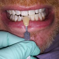 Promenade Dental Care ico