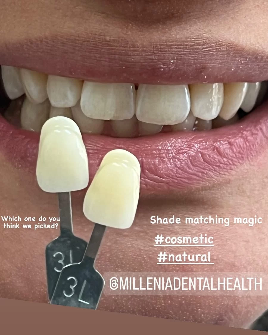 Millenia Dental Health Picture 3