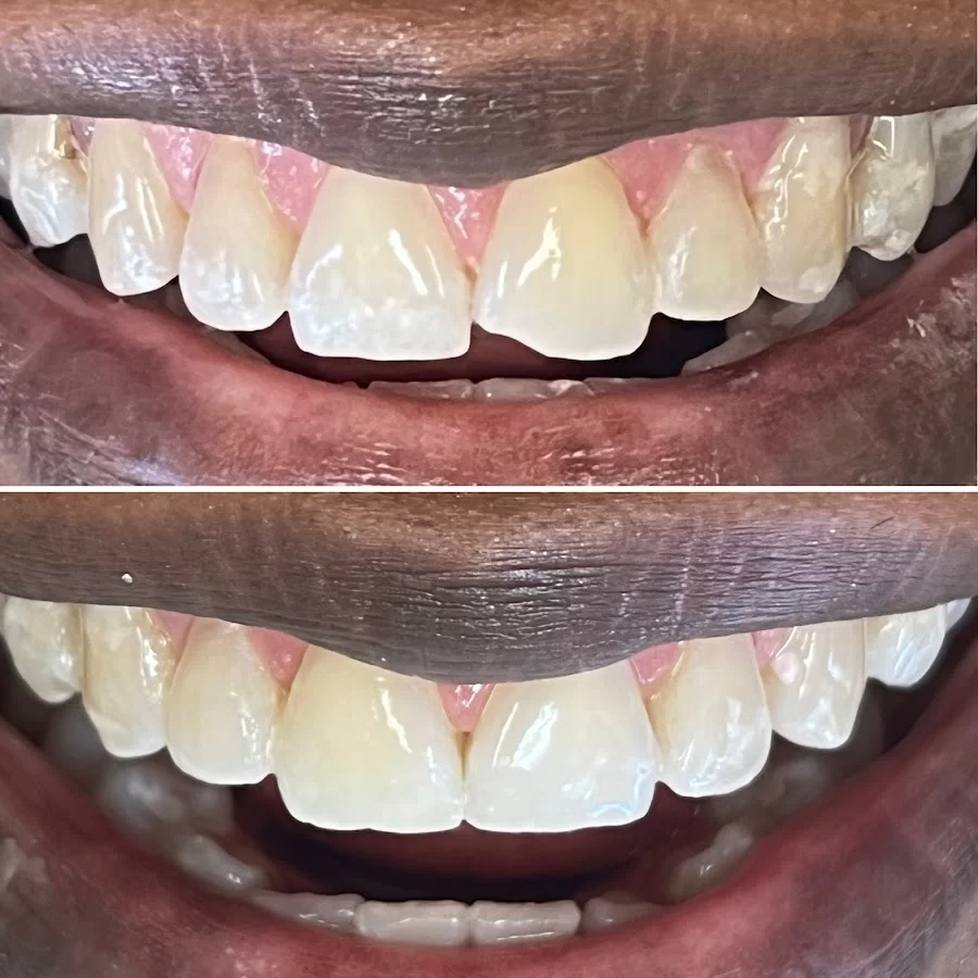 Millenia Dental Health Picture 2