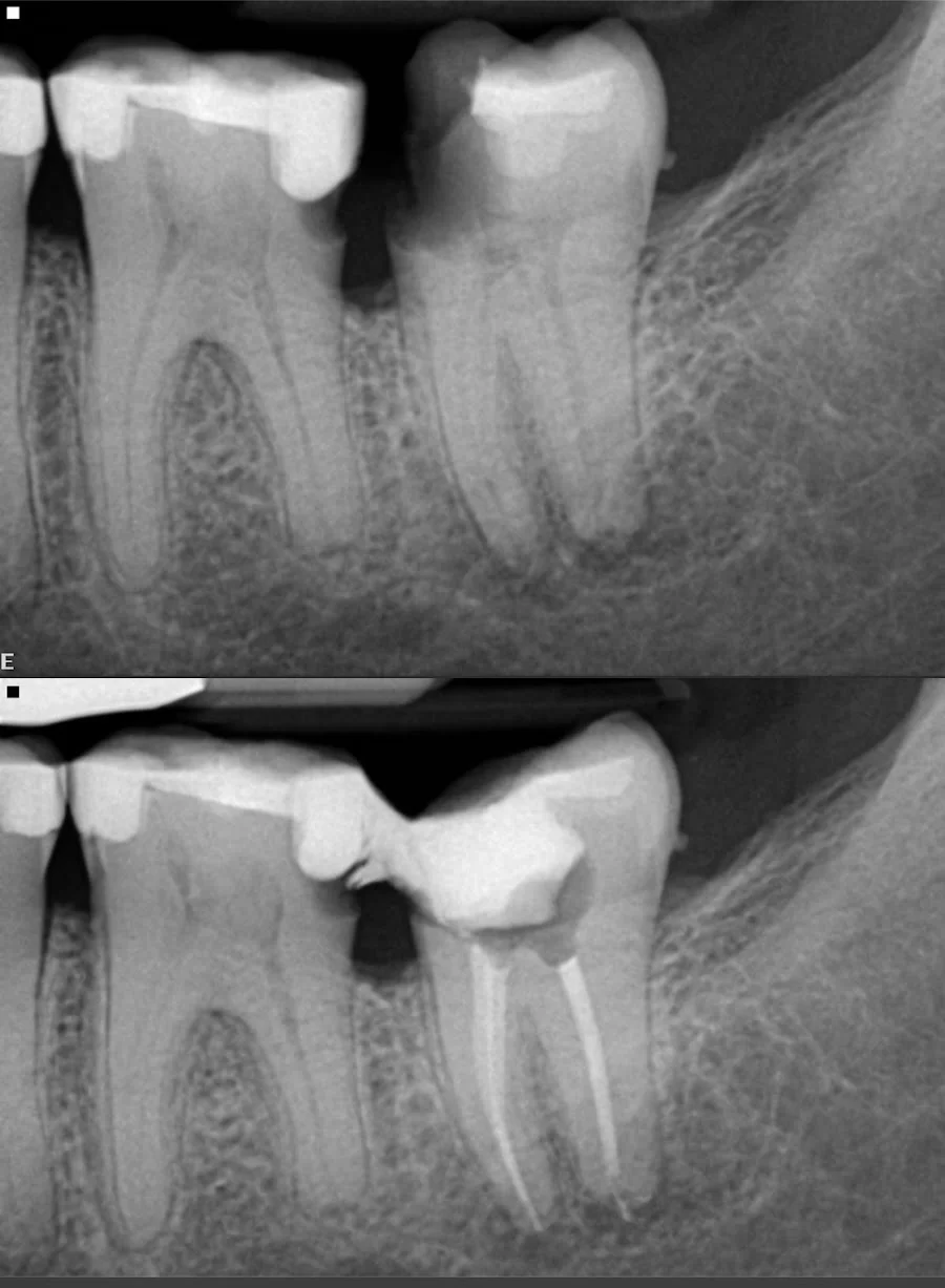 State Endodontics Picture 1