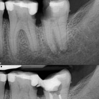 State Endodontics ico