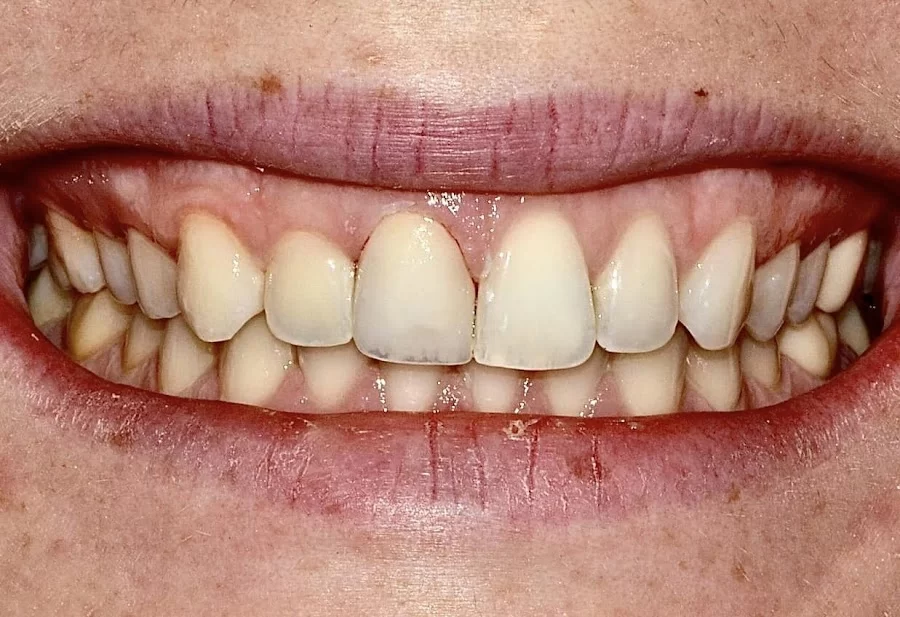 Art of Cosmetic Dentistry Picture 5