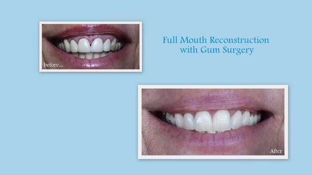 Thomas W Kauffman DDS PC Picture 1