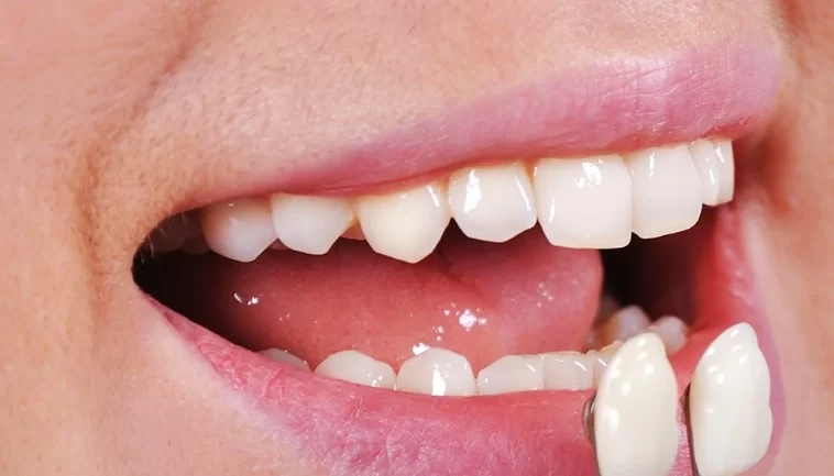 Orchard Meadows Family Dental & Denture Clinic Picture 1
