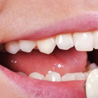 Orchard Meadows Family Dental & Denture Clinic ico