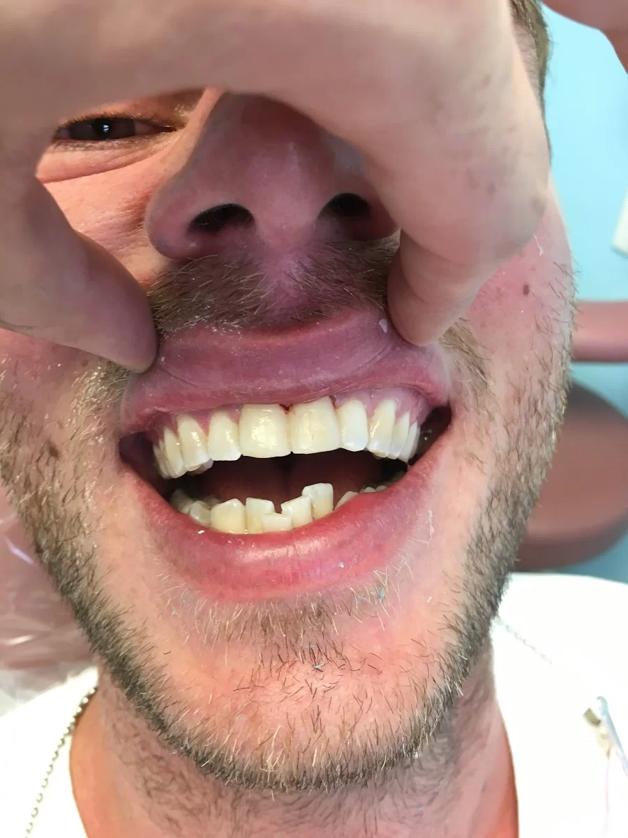 Emergency Dentist Brooklyn Services, PC Picture 5