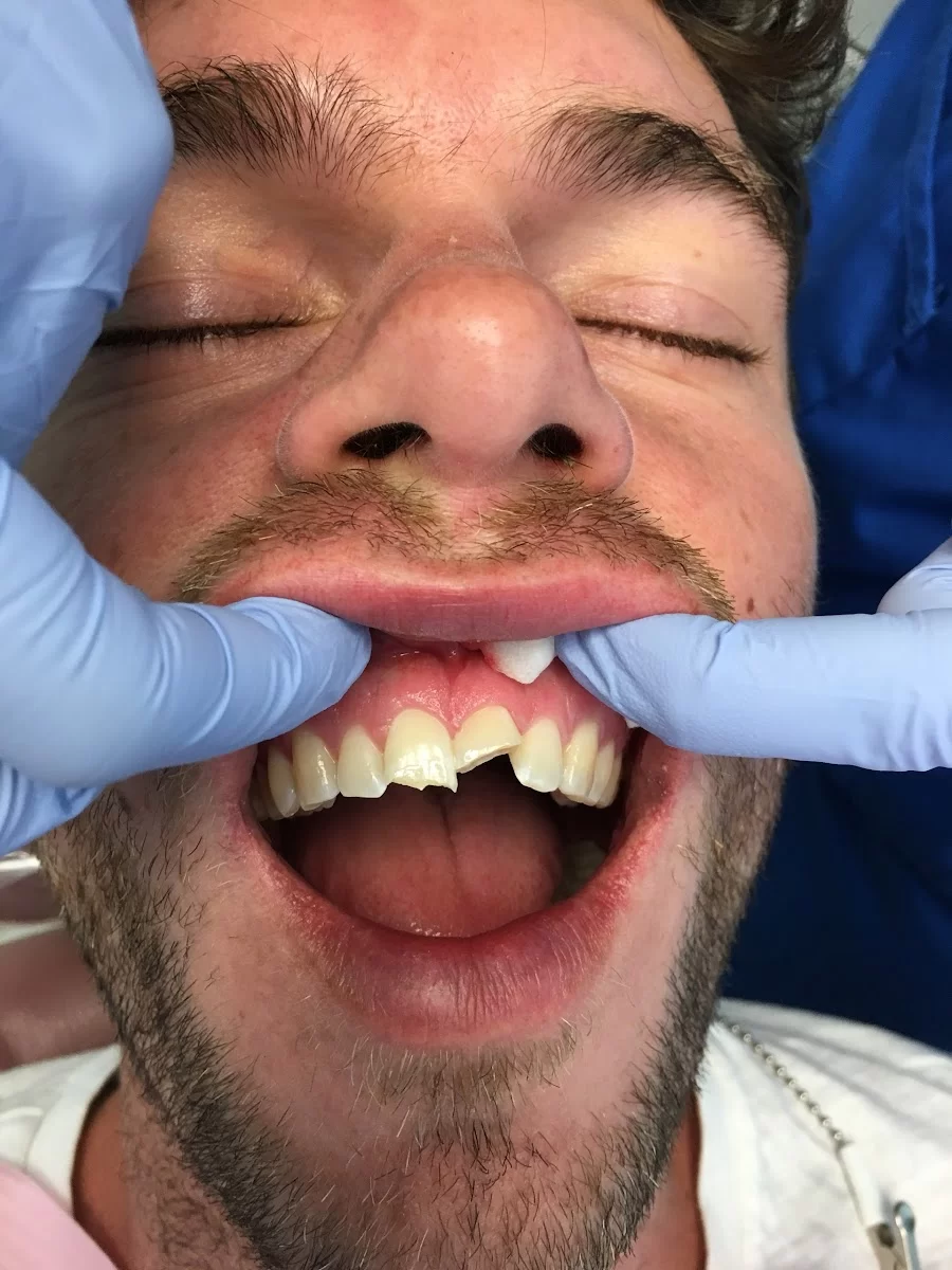 Emergency Dentist Brooklyn Services, PC Picture 6