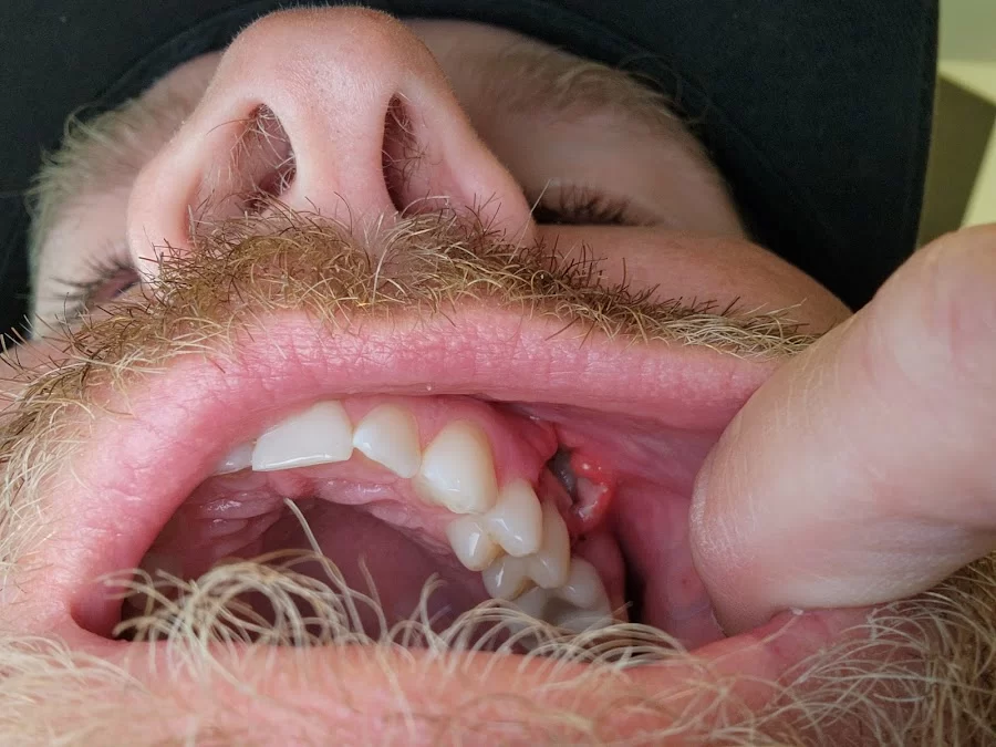 Dr. Bart B. Morrison, DDS Picture 1