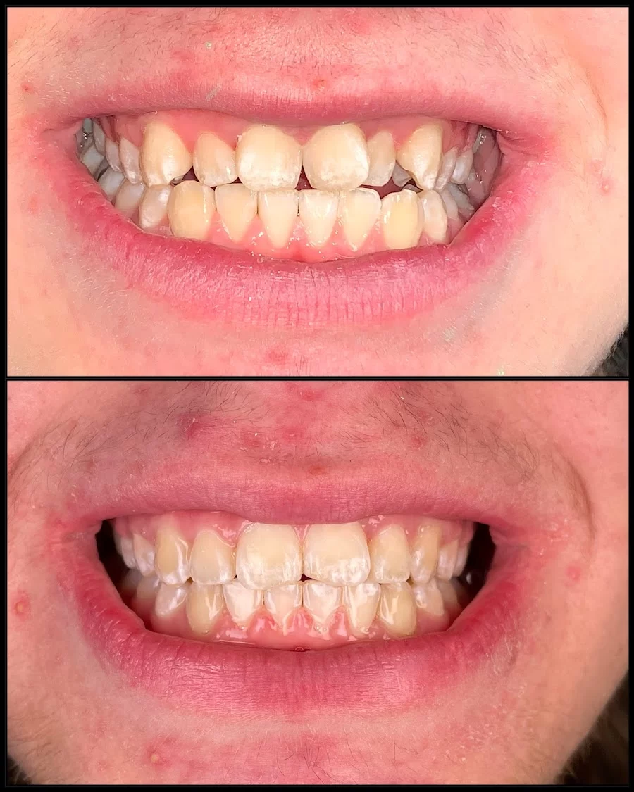 Rapid City Smiles: Implant & Family Dentistry Picture 5
