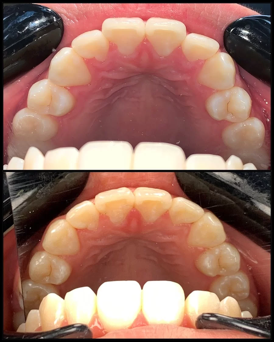 Rapid City Smiles: Implant & Family Dentistry Picture 7
