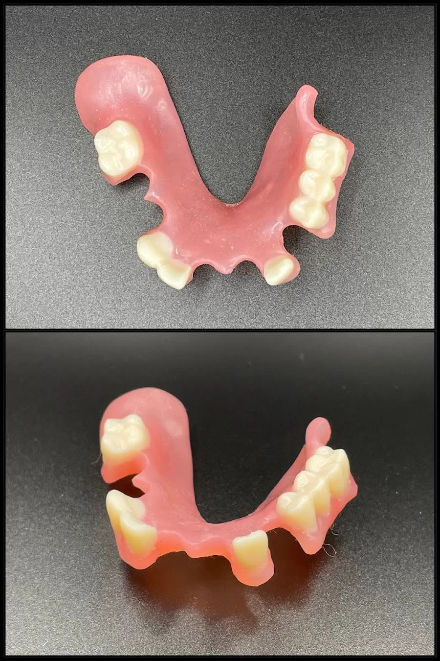 Rapid City Smiles: Implant & Family Dentistry Picture 10