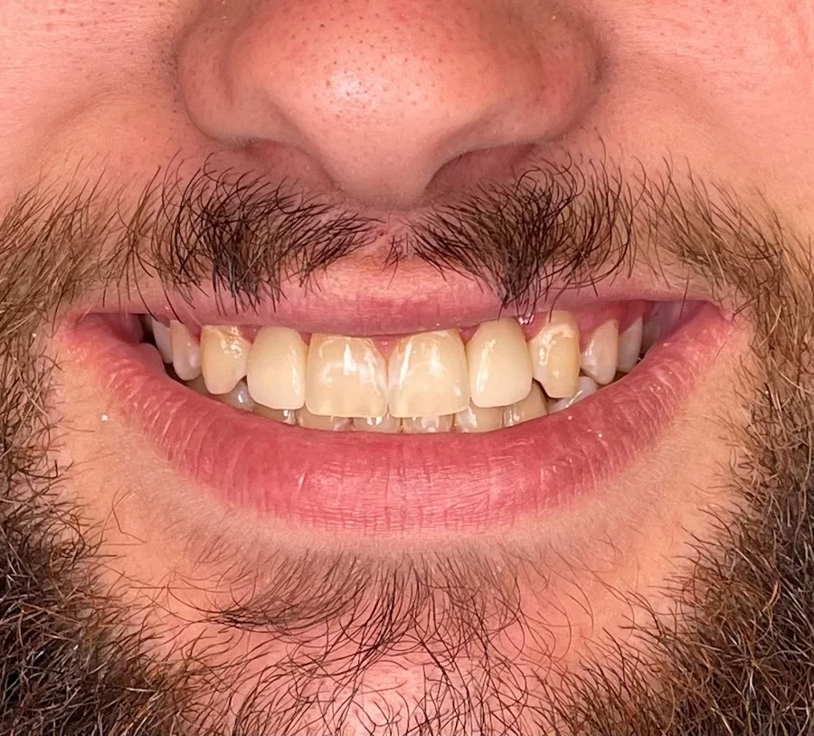 Rapid City Smiles: Implant & Family Dentistry Picture 8