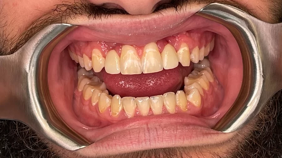 Rapid City Smiles: Implant & Family Dentistry Picture 2