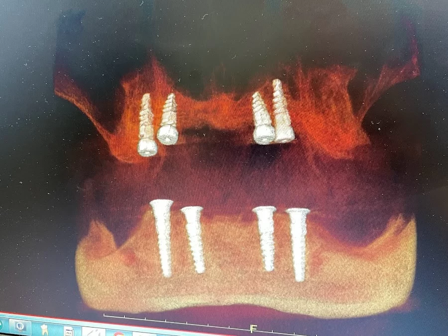 Rapid City Smiles: Implant & Family Dentistry Picture 6