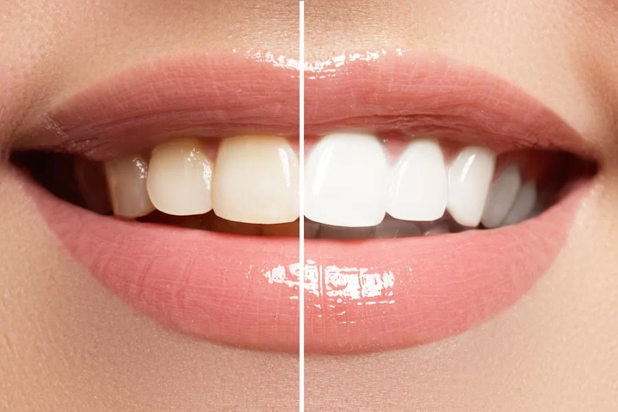 Maiden Lane Dental Picture 7