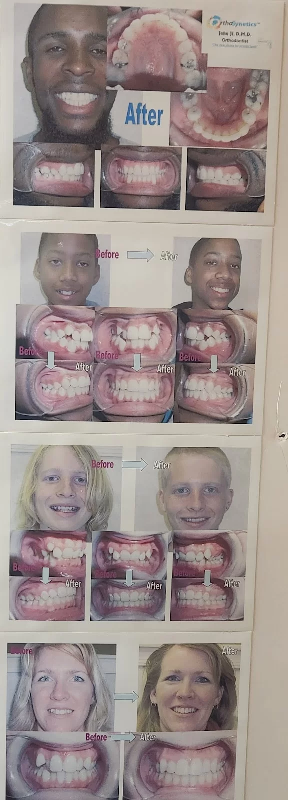 Ji Orthodontics Picture 1