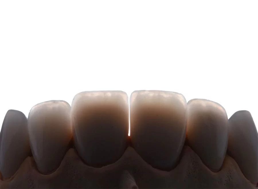 Fuller Smiles - Dentist - Long Beach Picture 1