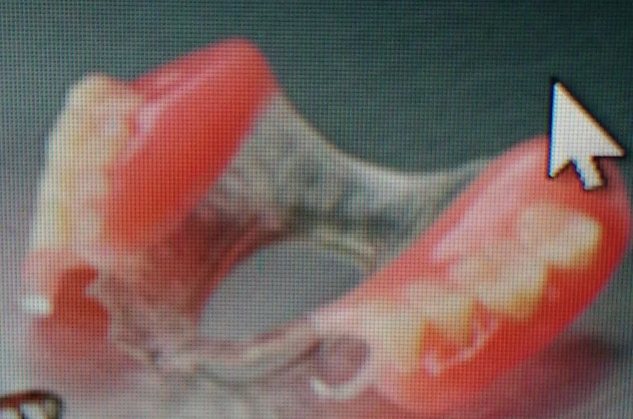 Ace Dental Technology Picture 4