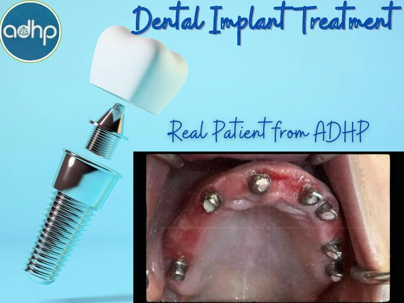 Affordable Dental Health Providers Picture 10