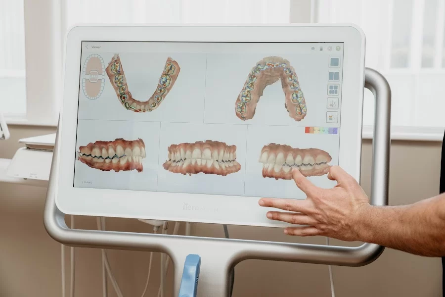 Long Beach Dental Health Picture 1
