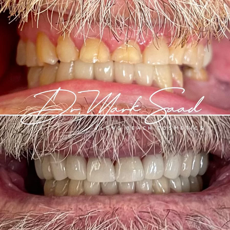 Long Beach Dental Health Picture 9