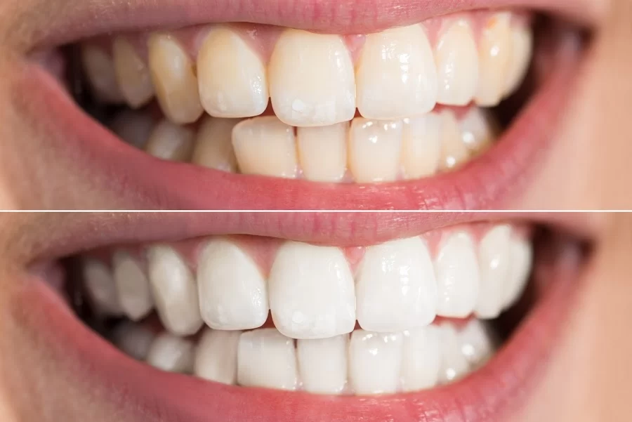 Perfect Smile Picture 3