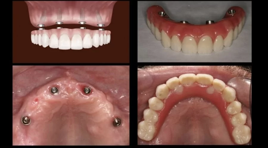 California Smile Dental Group Picture 1