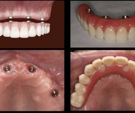 California Smile Dental Group