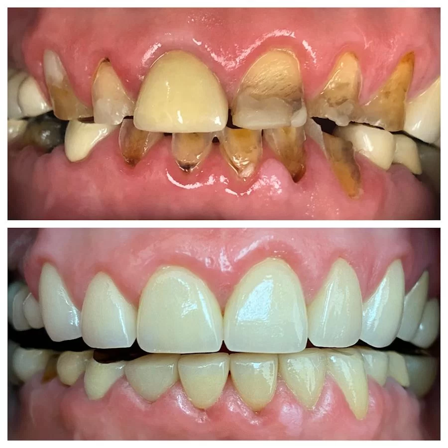 Commonwealth Dental - Brian Tadang, DDS Picture 10