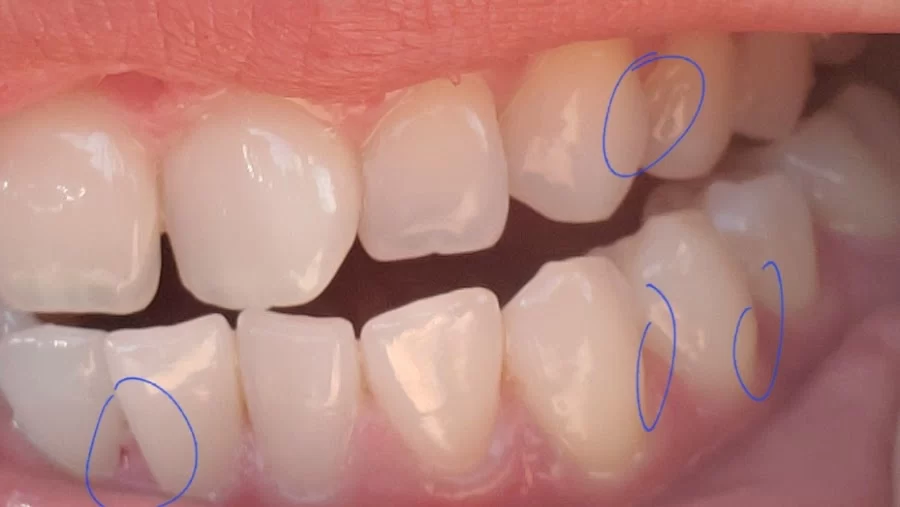Gold Coast Dental - Brea Picture 1