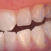 Gold Coast Dental - Brea ico