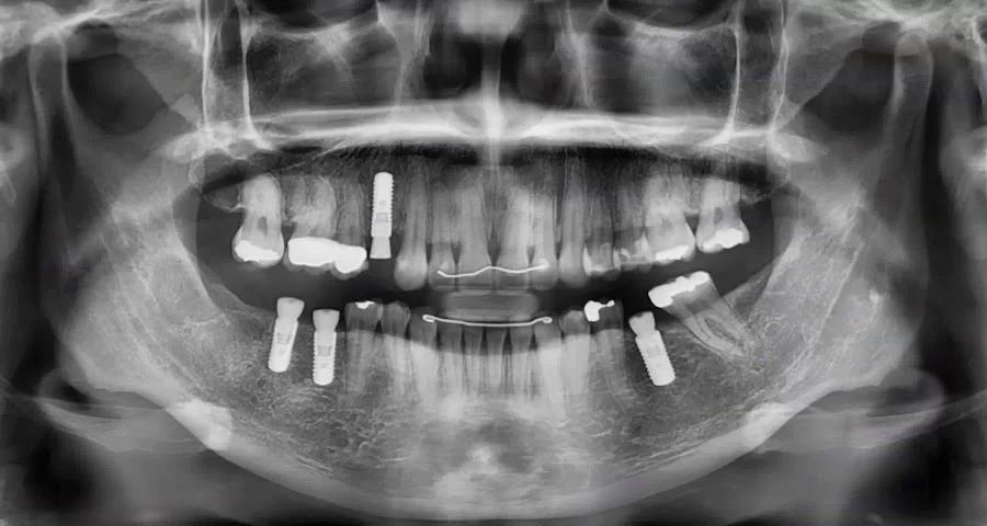 Torrance Oral Surgery Center Picture 3