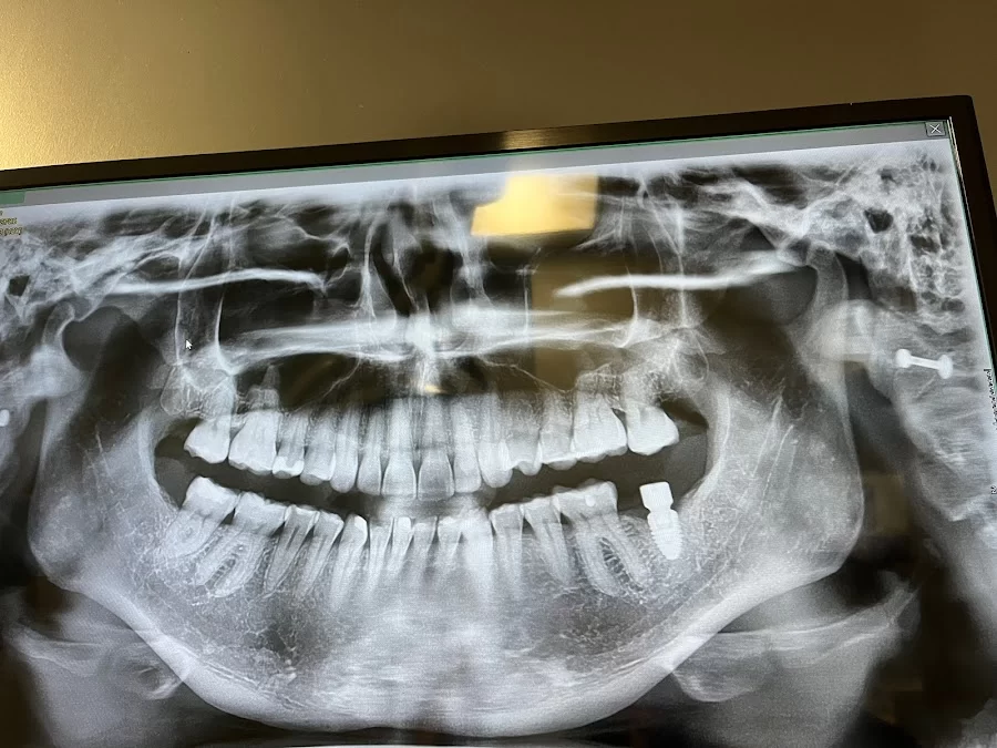 Torrance Oral Surgery Center Picture 9