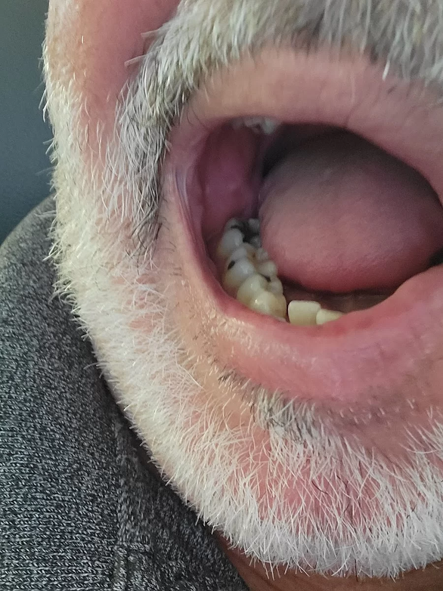 Glendora Dental Center Picture 4