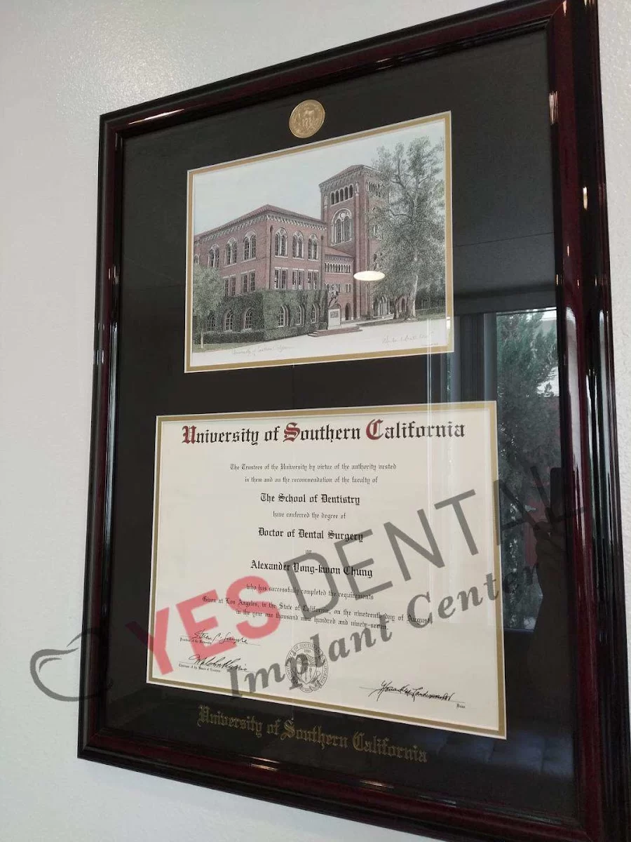 Yes Dental Implant Center Picture 9