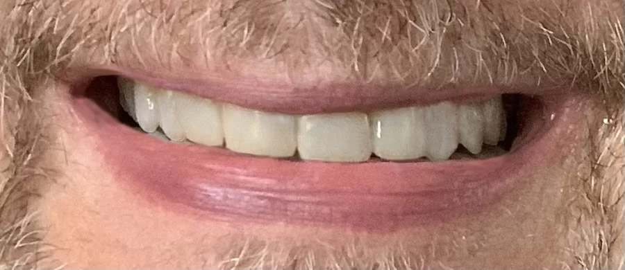 implantasmile.com | Antoine S. Sayegh, DDS Picture 3