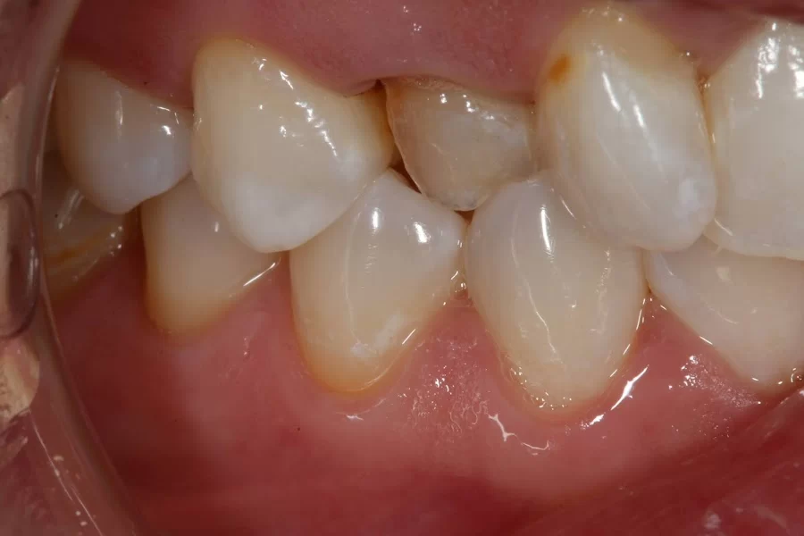 implantasmile.com | Antoine S. Sayegh, DDS Picture 6