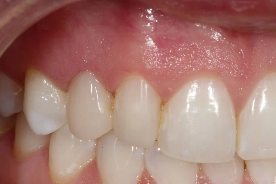 implantasmile.com | Antoine S. Sayegh, DDS Picture 5