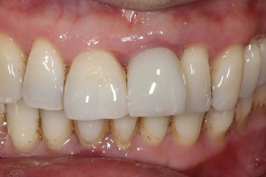 implantasmile.com | Antoine S. Sayegh, DDS Picture 1