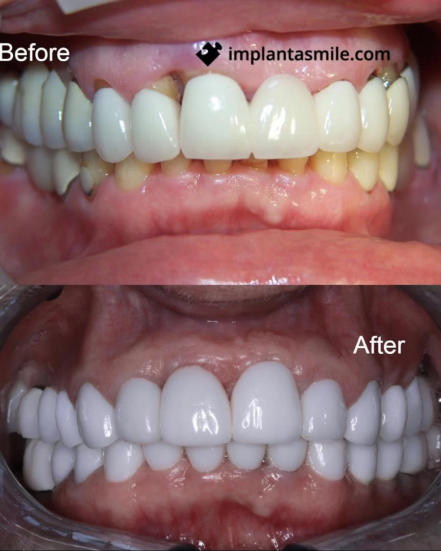 implantasmile.com | Antoine S. Sayegh, DDS Picture 10