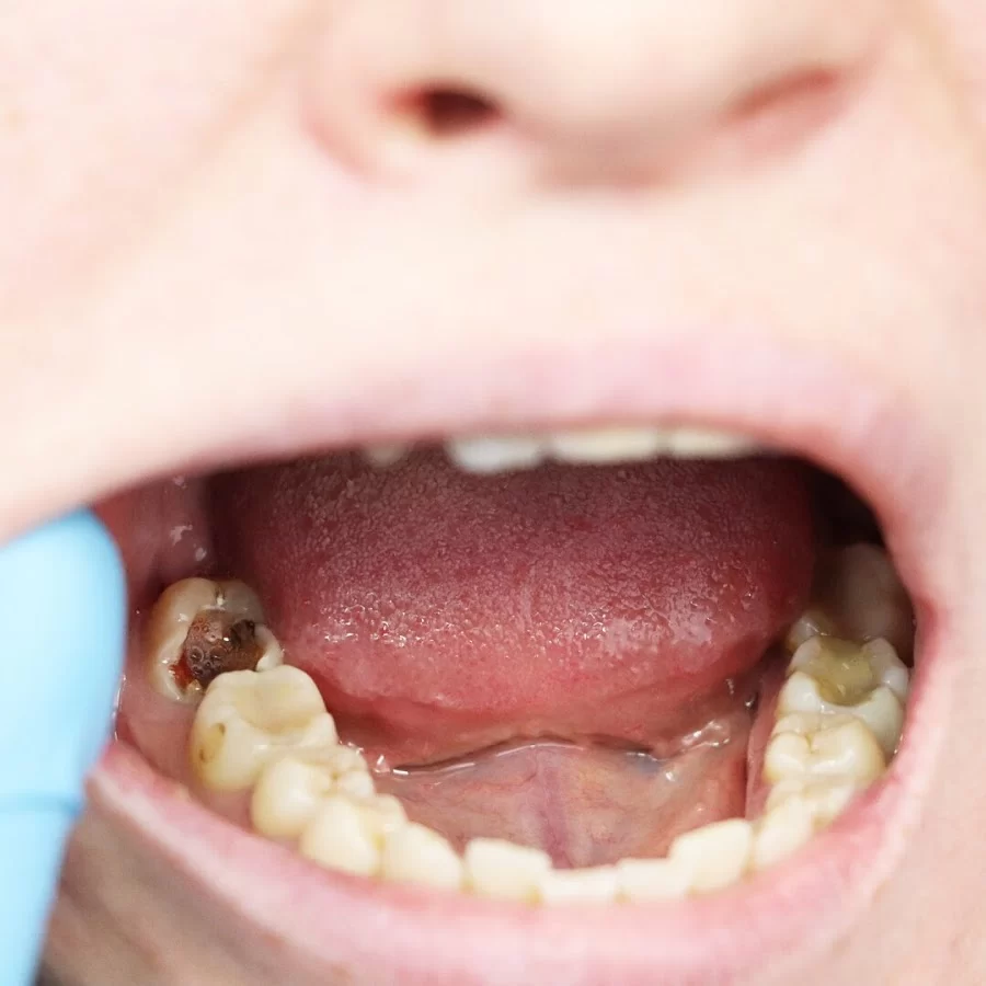 Cypress Dental Picture 8