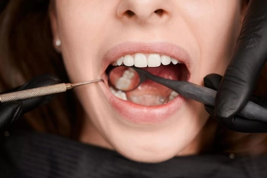 Cypress Dental Picture 4
