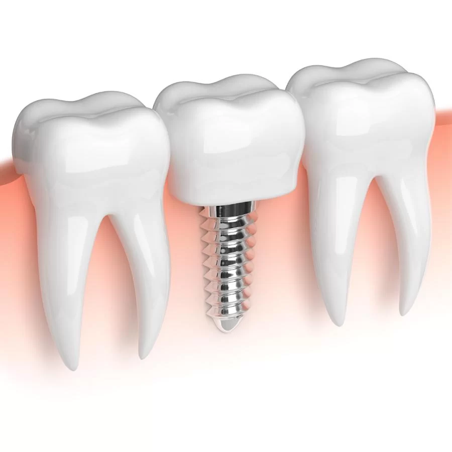 Cypress Dental Picture 9