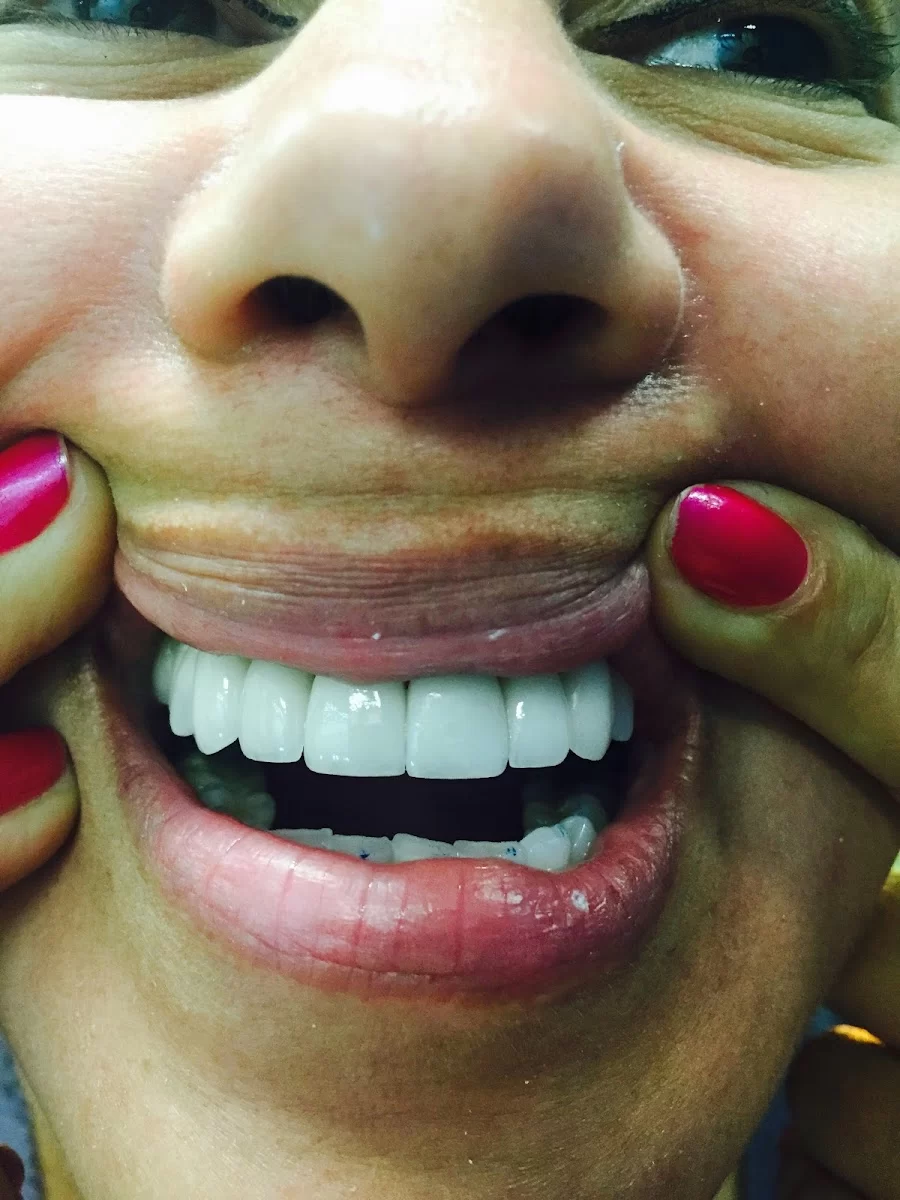 City Dental Centers Azusa, CA - Dentist in Azusa Picture 5