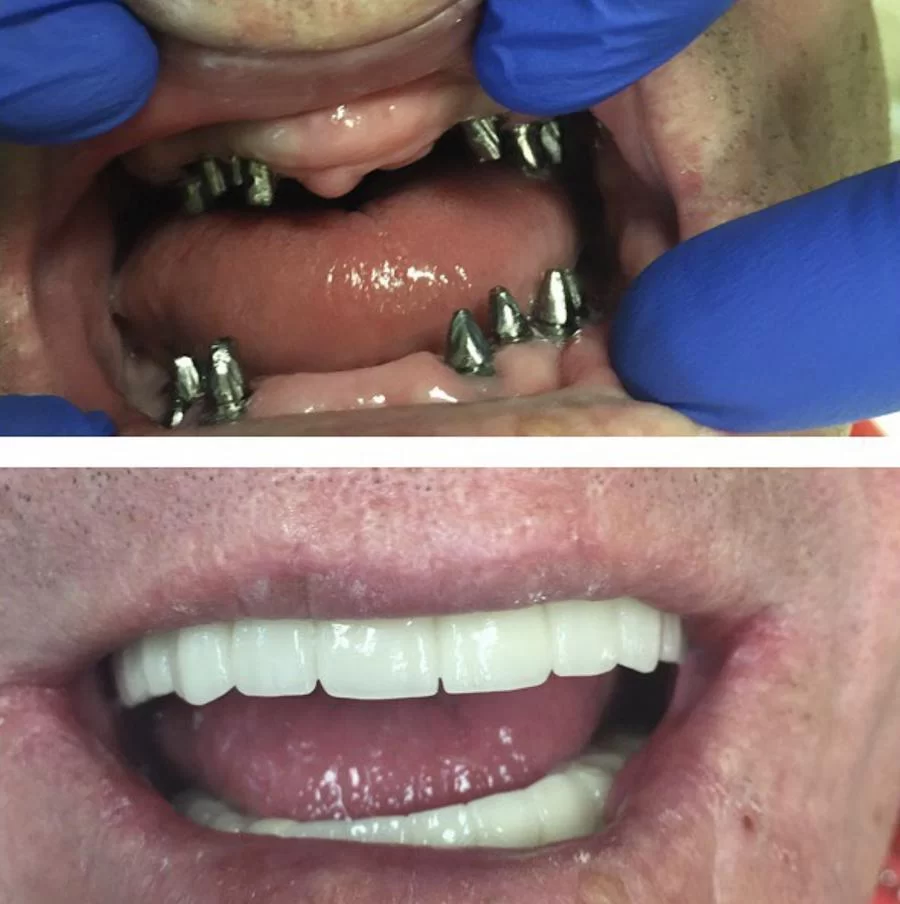 City Dental Centers Azusa, CA - Dentist in Azusa Picture 9