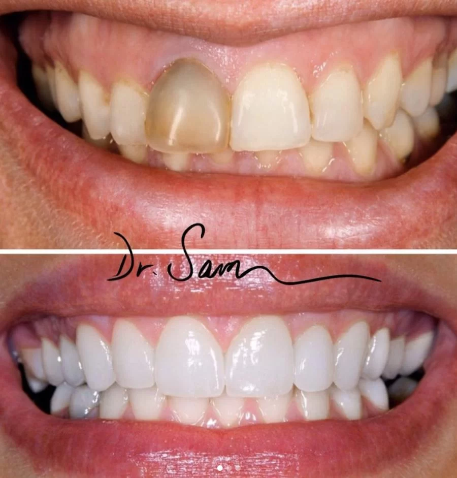 City Dental Centers Azusa, CA - Dentist in Azusa Picture 7