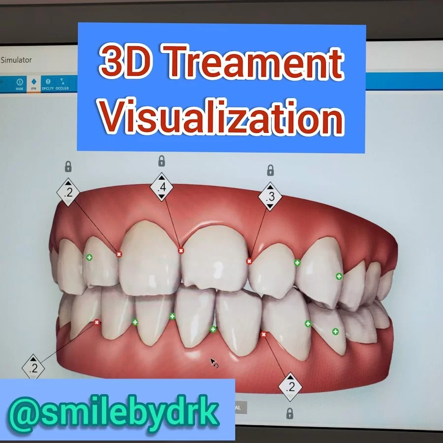 Smile By Dr. K Picture 4